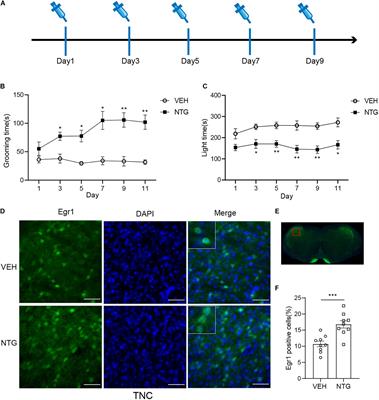 Detecting Abnormal Neuronal Activity in a Chronic Migraine Model by Egr1-EGFP Transgenic Mice